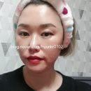 미현 인셀덤