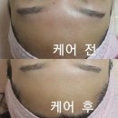 에스케어 이미지