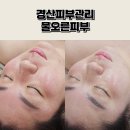 지에스(GS)25 울진군청점 | 경산피부관리 잘하는 물오른피부 홍조 여드름 관리 내돈내산 솔직후기