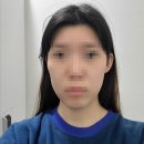 티티성형외과의원 | [신논현/뷰티] '티티성형외과의원'에서 자연스러운 얼굴라인 교정 필러 받은 후기
