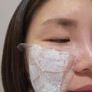 건대예쁨주의쁨의원 | 건대 예쁨주의쁨 필로드 스킨부스터 후기 예쁨주의쁨