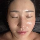애띠스킨케어 이미지