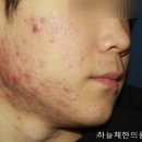 조숙헤어라인