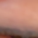 컴포트성형외과의원 이미지