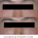 셀린의원 하남미사 | 미사 하남피부과 5월 : 뷰티오션의원 오메이징 이벤트! 수면리쥬란 텐쎄라 마운자로 바디리프팅 온다