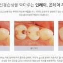 나의미소치과의원 네이버블로그