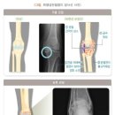 누가정형외과의원 이미지