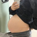 씨유(CU) 좋은강안병원점 | 강북삼성병원 제왕절개 후기 1일차