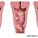 리움여성의원 이미지