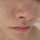 오산 청학동 피부관리 여드름 피부 진정케어로 깨끗하게 뷰온뷰티 다녀온 후기