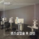 제곱밀리미터 | 렌즈삽입술 1달 차 검진 결과 분석: 시력·안압·볼팅·각막세포 및 솔직 부작용