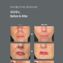 위코