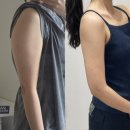 해보리 | 천호 팔뚝 람스 후기 2편 | 예신다이어트 람스드메 혜택으로 비용 줄이기