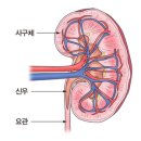 급성 신우신염(Acute pyelonephritis) 신장 비뇨기질환이란? 이미지