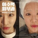 선헤어탁터 | 이수역 피부과 중안부 볼륨에 효과적인 티타늄리프팅 후기