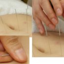 전곡한의원 이미지