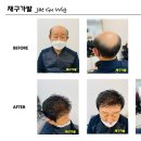재구가발