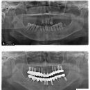 엘치과병원 이미지