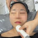 뷰티에이 | 뷰티에이 인퓨즈웨이브 관리 후기 천안 불당동 피부관리 추천