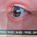 부산아이센터안과의원 이미지