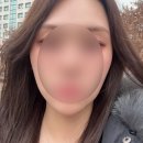 11620-21-43-13 | 피부과전문의한테 받은 강남역울쎄라 2개월차 후기 (feat. 울쎄라+퍼펙트티타늄 붓기 경과 상세 기록...