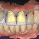 수인치과기공소 이미지