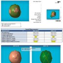 지오 | 사두,사경 진단 후 두상교정 '지오헬멧' 후기