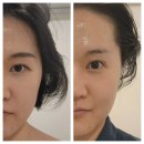 연뷰티샵 | [강북구 미아동] 얼굴관리 잘하는 미아역 강북구피부관리샵 예시연뷰티랩 솔직후기