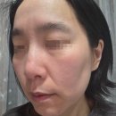 💧 쩍쩍 갈라지는 겨울 피부 심폐소생술! 웰더마 피팅 마스크 스킨 부스터 스타터팩 4종 찐후기