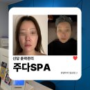 신당(금호) | 신당 윤곽관리 | 주다SPA 이중턱소멸관리 받고 턱선 살아난 후기