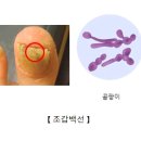 백선 이미지