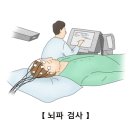 발작[Seizure]뇌신경 정신질환 이미지