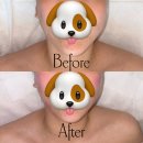 화곡 웨딩케어 효과좋은 신부관리│아이엠파인 얼굴리프팅 딱프팅 쫀프팅 후기