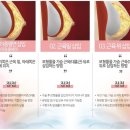 고은리프트의원 이미지