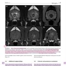 CNS에 hemangiosarcoma가 이환된 개에서의 MRI 상 특징 이미지