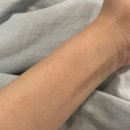 슬로독 | 겨울만 되면 아토피 피부가 찢어지는 이유, 보습을 이렇게 바꿔야 해요