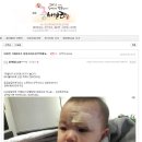 태권도자병체육관 | 217일 아기 눈썹찢어짐 아기봉합