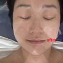 보람동_호려울302동 건너편 | 세종 보람동 피부관리 셀앤수 세종보람점 물방울초음파관리