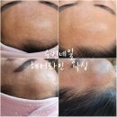 수빈헤어라인 이미지