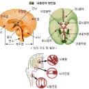 중풍 뇌경색 자가 진단법 이미지