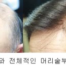 아이모헤어