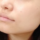 주식회사 마이크로발란스 이미지