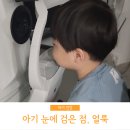 아기 눈에 회색 점 검은 얼룩 커져서 안과 방문! + 유아 정상 시력