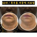 포천목주름관리 송우리목주름관리 포천이중턱관리 포천피부관리 / 어썸웰스파