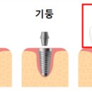 인제치과기공소 이미지