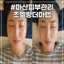 김진명의 ''''어떤 힘을 기를 것인가?'''' | 마산 피부관리 양덕동 조엘랑더마랩 속건조 피부 슈퍼젝션 후기