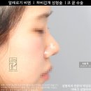 아베크 성형외과의원 이미지