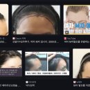 라메종피부과의원 네이버블로그