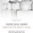 수성뉴플란트치과의원 이미지