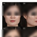 서울나온피부과의원 네이버블로그